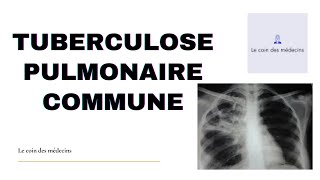 TUBERCULOSE PULMONAIRE COMMUNE [upl. by Aliuqaj]