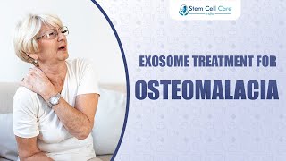 Exosome Treatment For Osteomalacia  Osteomalacia Treatment  Stem Cells  Orthopedic Disease [upl. by Aligna]