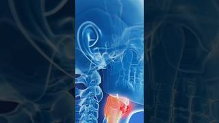 Causes of Throat Cancer short throatcancer cancer [upl. by Aneekal]