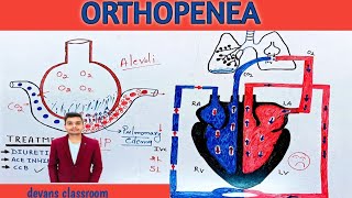 Orthopnea  machanism of orthopnea in hindi [upl. by Airetak]