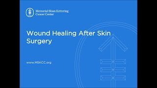 Wound Healing After Skin Surgery  Memorial Sloan Kettering [upl. by Sherlock]