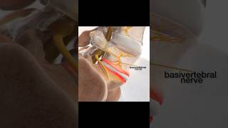 Basivertebral nerve ablation procedure [upl. by Hachman]