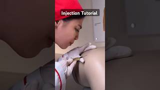 Injection Tutorial tutorial injection shorts littos [upl. by Litnahc]