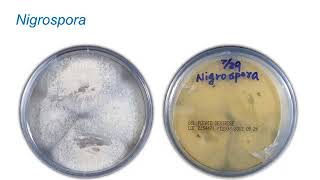 Identification of Melanized Dermatitiaceous Fungi Part 1 Hot Topic [upl. by Elagiba]