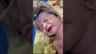 Suction process mouth and nose newborn baby remove bad water from stomach 🤧😞 [upl. by Amethyst]