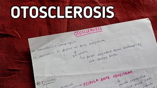 OTOSCLEROSIS  ENT [upl. by Flss]