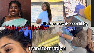 Hair PRP treatment and the results  Real transformation  srideviscontour sridevithiyagarajan [upl. by Lenoel155]