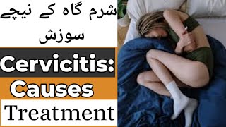 What is cervicitis Causes of Cervicitis sign and symptoms Treatment of Cervicitis in Hindi [upl. by Olenta]