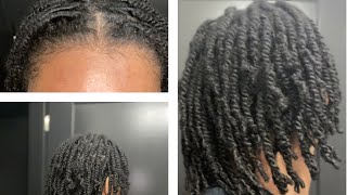 Starter locs1 MONTH UPDATE [upl. by Lesko]