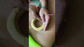 KATI VASTI  Back pain treatment  AYURVEDA [upl. by Htor809]