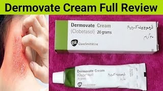 Dermovate Cream Review Benefits Side Effects And Uses  Cream For Eczema [upl. by Einnek]