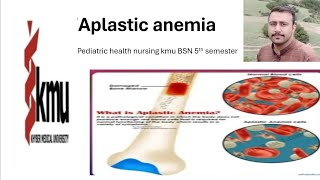 aplastic anemia pediatric health nursing kmu BSN 5th semester [upl. by Anawal]