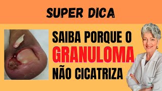 Porque o Granuloma Não Cicatriza [upl. by Guinn112]