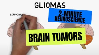 2Minute Neuroscience Brain tumors [upl. by Aneek]