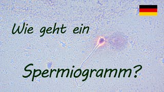 Wie geht ein Spermiogramm  Urologe Göttingen [upl. by Yrkcaz]