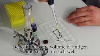 How to perform a Rapid Slide Agglutination Test [upl. by Honniball]