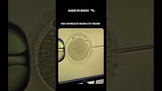 In vitro fertilization IVF or tube baby [upl. by Robinia]