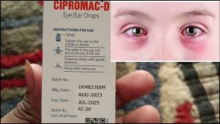 Eye Drops red cause how to drops [upl. by Yro]