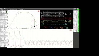 A Cardioprotective Mindset Myocardial Energetics and Ventricular Unloading in Cardiogenic Shock [upl. by Amsa]