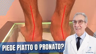 Piede pronato valgo Il quotFALSO PIEDE PIATTOquot  Come riconoscere il piede pronato [upl. by Krystalle]