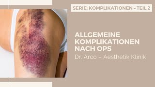 Bluterguss und Entzündung nach Operation  Komplikationen – Teil 2  Dr Arco – Aesthetik Klinik [upl. by Neyugn]