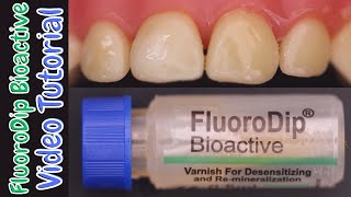 FluoroDip BioactiveA Revolutionary Fluoride Varnish with BIOGLASS 🔵 How To use amp Why To Use 🟢 [upl. by Fontes597]