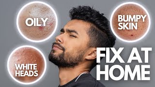 6 Skin Problems You Can Fix At Home FAST [upl. by Liu950]