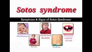 Sotos syndrome mrcpch Clinical General Examination [upl. by Lattie]