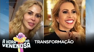 Joelma faz procedimento estético e fãs notam diferença [upl. by Marcella327]