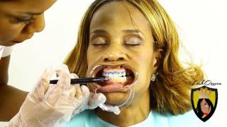 TEETH WHITENING TUTORIAL How to Start a TEETH Whitening Business amp Is Teeth Whitening Legal [upl. by Airdnua15]