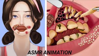 asmr animation mouth cleaningasmr asmr animation treatment [upl. by Tesil]