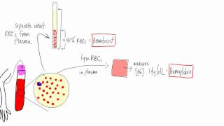 Anemia Basic lab tests  hematocrit hemoglobin reticulocyte MCV morphology [upl. by Norraj]