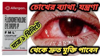 FML eye drops benefits use in bengali review How to benefits in FML eye drops [upl. by Imrots]