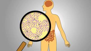 Acute Radiation Syndrome [upl. by Tiat]