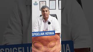 Common Types of Hernia And Its Types hernia herniatreatment [upl. by Chaney593]