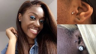 Tragus Got Infected Video  Pictures Inside [upl. by Stranger134]