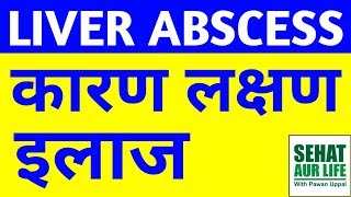 Liver Abscess कारण लक्षण इलाज Causes Symptoms Diagnosis Treatment In Hindi [upl. by Fasta297]