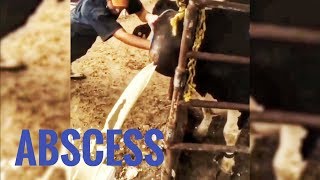 BEST ABSCESS COMPILATION [upl. by Ran]