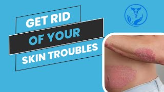 GET RID OF YOUR SKIN RASH  BEST WAY TO VANISH UR SKIN DISEASES  Homeopathy with Dr Anoosha Hashmi [upl. by Itnahsa36]