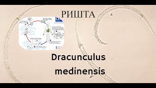 Ришта Dracunculus medinensis  Морфология Жизненный Цикл Диагностика Лечение Профилактика [upl. by Nosremaj206]