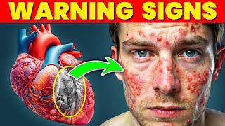 13 Skin Signs of SERIOUS Heart Problems [upl. by Novat]