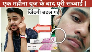 30 days use after honest review Kozicare skin whitening cream [upl. by Zawde743]