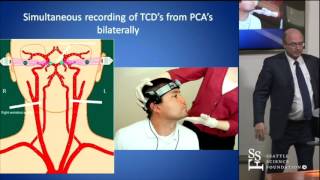 Head Turn Syncope Rotational Vertebrobasilar Ischemia by David Newell MD [upl. by Milstone739]