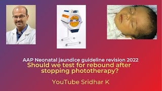 Should we test for rebound after stopping phototherapy Neonatal jaundice neonataljaundice [upl. by Ledif107]