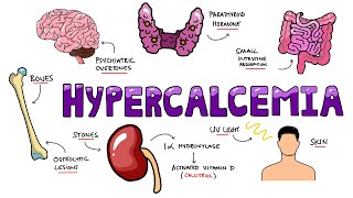 An Approach to Hypercalcemia  Causes Calcium Homeostasis Mechanisms amp Signs and Symptoms Mnemonic [upl. by Eardna]