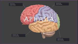 Brocas or Wernickes Aphasia on the NPTE [upl. by Asihtal]