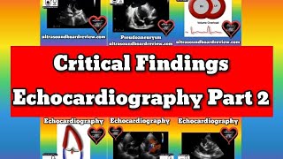 Critical Findings in Echocardiography [upl. by Ioved]