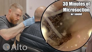 30 Minutes of MICROSUCTION Ear Wax Removal [upl. by Krysta968]