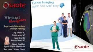 Experience ESAOTE Virtual Navigator fusion imaging TRAILER [upl. by Atnahsal]