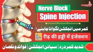 Nerve Block Injection  Good or Bad  UrduHindi [upl. by Otrebogir]